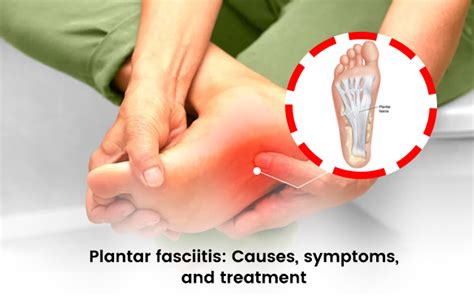 noduläre fasziitis|Nodular Fasciitis: Pathology, Causes & Treatment